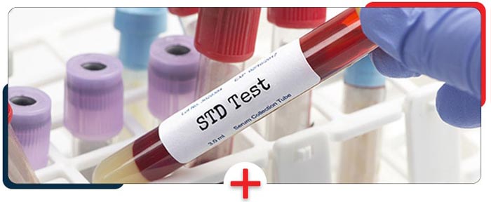 Confidential STD Testing & Treatment Near Me in Clio, MI Confidential STD Testing & Treatment Near Me in Clio, MI
