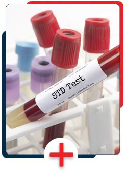 STD Testing Near Me in Clio, MI