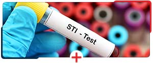 STI Testing Clinic Near Me in Clio MI 